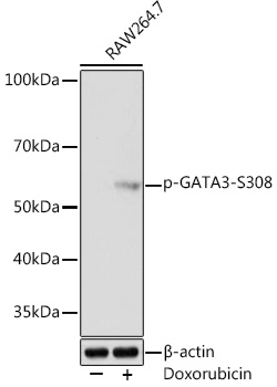 Anti-Phospho-GATA3-S308 Antibody (CABP1015)