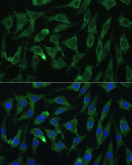 Anti-Argonaute-2 Antibody (CAB6802)