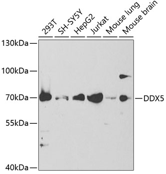 Anti-DDX5 Antibody (CAB5296)