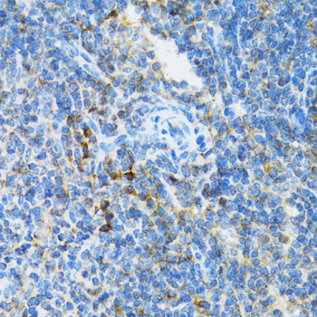 Anti-UBE2D1 Antibody (CAB1951)