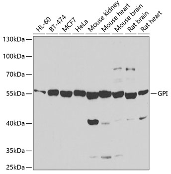 Anti-GPI Antibody (CAB6916)