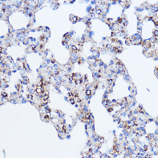 Anti-IL-11 Antibody (CAB1902)