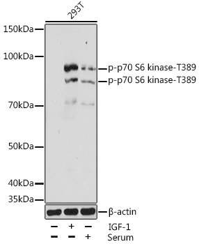 Anti-Phospho-p70 S6 kinase-T389 Antibody (CABP1059)