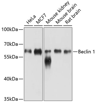 Anti-Beclin 1 Mouse Monoclonal Antibody (CAB10101)