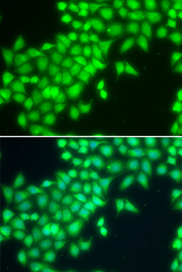 Anti-METTL2A Antibody (CAB7290)