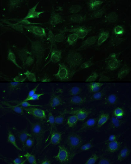 Anti-COX6A1 Antibody (CAB3798)