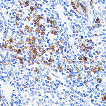 Anti-TNFSF12 Antibody (CAB5659)