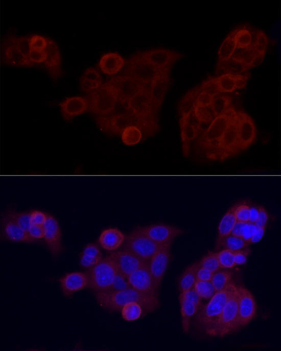 Immunofluorescence analysis of HepG2 cells using GPBAR1 antibody at dilution of 1:100 (40x lens). Blue: DAPI for nuclear staining.