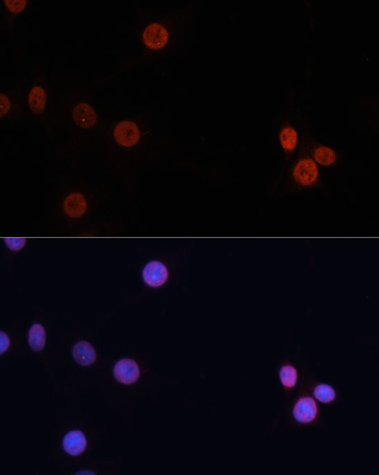 Anti-DNMT3B Antibody (CAB2899)