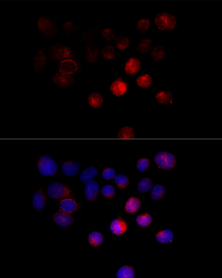 Anti-TOM1 Polyclonal Antibody (CAB9273)