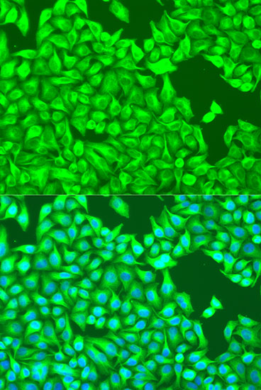 Anti-TUBB8 Antibody (CAB12617)