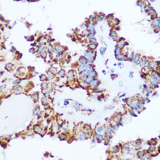 Anti-PDHA1 Antibody (CAB17432)