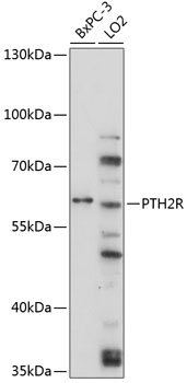 Anti-PTH2R Antibody (CAB4058)