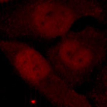 Anti-Phospho-HDAC2-S394 Antibody (CABP0201)