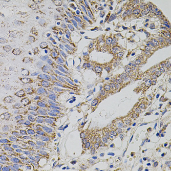 Anti-TRMT2A Antibody (CAB5975)