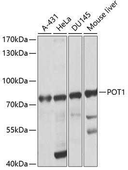 Anti-POT1 Antibody (CAB1491)