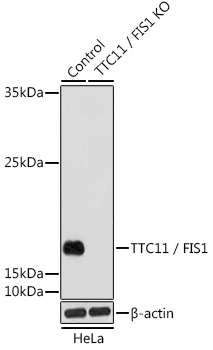 Anti-TTC11 / FIS1 Antibody [KO Validated] (CAB5821)