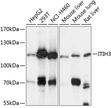 Anti-ITIH3 Polyclonal Antibody (CAB9459)