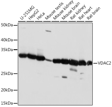 Anti-VDAC2 Antibody (CAB18683)