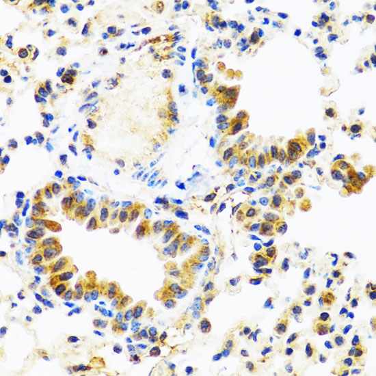 Anti-C8orf4 Antibody (CAB6241)