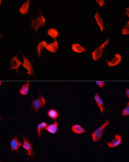 Anti-CAMK2G Antibody (CAB3231)