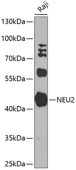 Anti-Sialidase-2 Polyclonal Antibody (CAB8137)