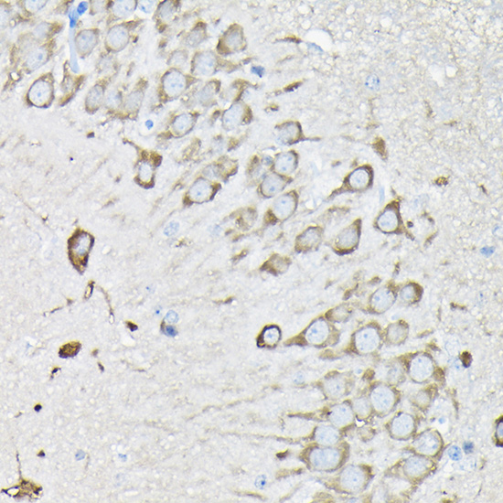 Anti-EEF1A2 Antibody (CAB7327)