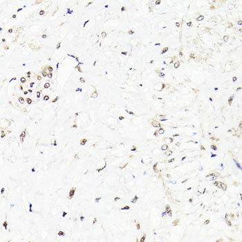 Anti-FKBP5 Antibody (CAB3863)