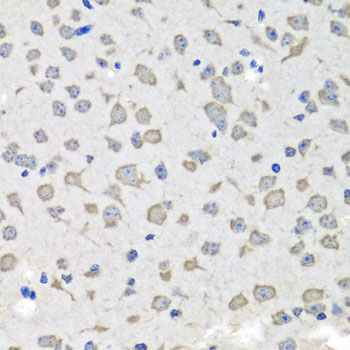 Anti-C1GALT1C1 Antibody (CAB7590)