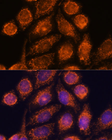 Anti-MTMR9 Antibody (CAB13124)