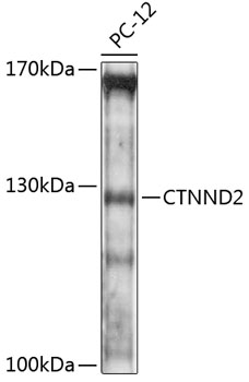 Anti-CTNND2 Antibody (CAB12633)