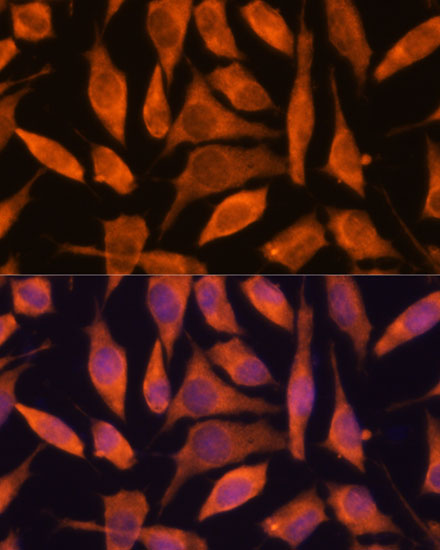 Anti-SCRN3 Antibody (CAB14421)