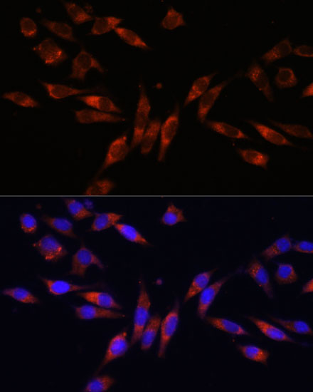 Anti-COL4A3 Antibody (CAB16359)