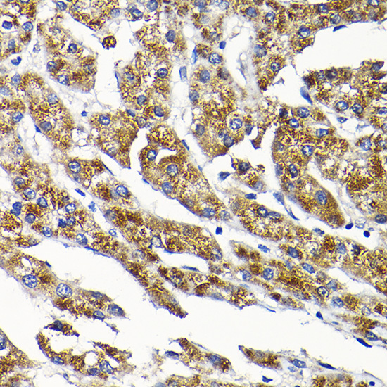 Anti-SCFD1 Polyclonal Antibody (CAB8835)