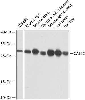 Anti-Calretinin Polyclonal Antibody (CAB9807)