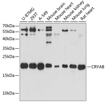 Anti-CRYAB Antibody (CAB13696)