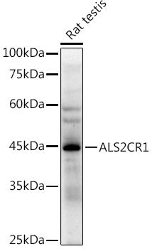 Western blot analysis of extracts of Rat testis, using at 1:500 dilution. Secondary antibody: HRP Goat Anti-Rabbit IgG (H+L) at 1:10000 dilution. Lysates/proteins: 25ug per lane. Blocking buffer: 3% nonfat dry milk in TBST. Detection: ECL Enhanced Kit. Exposure time: 90s.