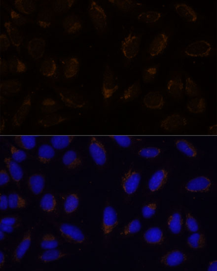 Anti-CD133 Antibody [KO Validated] (CAB12711)