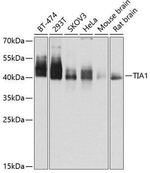 Anti-TIA1 Antibody (CAB12517)