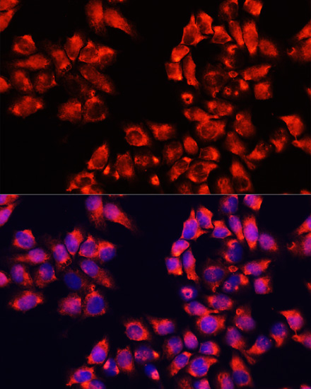 Anti-ALDH7A1 Polyclonal Antibody (CAB8629)