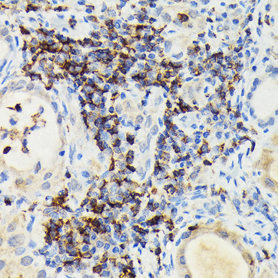 Anti-PIK3CG Antibody (CAB6688)