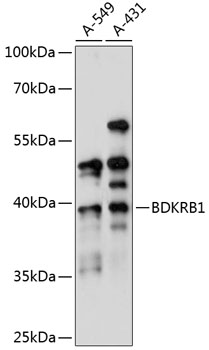 Anti-BDKRB1 Antibody (CAB1959)