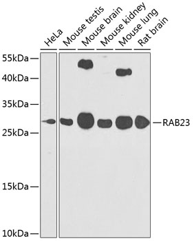 Anti-RAB23 Polyclonal Antibody (CAB7979)