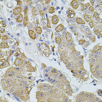 Anti-TRPA1 Polyclonal Antibody (CAB8568)