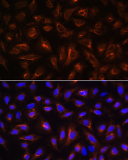 Anti-ARL13B Antibody (CAB5200)