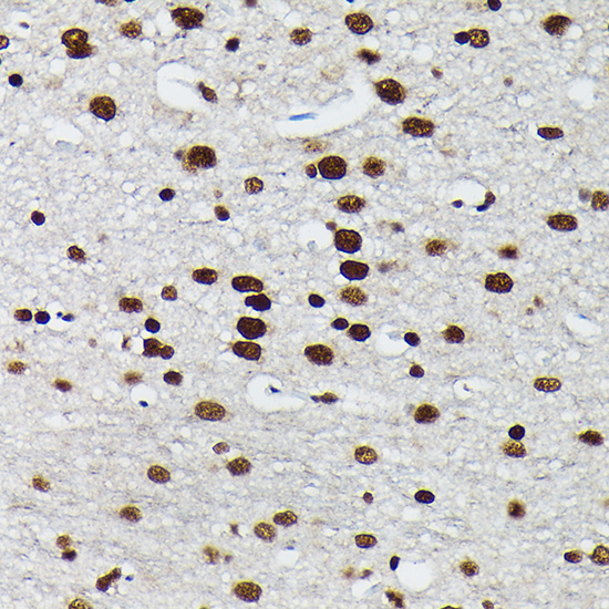 Anti-Phospho-JUN-S73 Antibody (CABP0119)