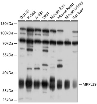 Anti-MRPL39 Antibody (CAB10023)