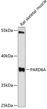Anti-PARD6A Antibody (CAB12755)