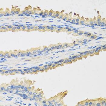 Anti-LEP Antibody (CAB5673)