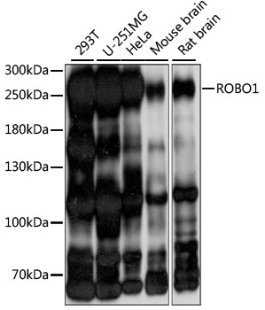 Anti-ROBO1 Antibody (CAB15313)